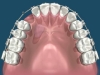 Orthodontic Related Procedures