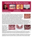Implants for Dentures