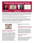 Tooth Extraction