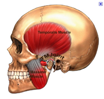 TMJ & Facial Pain
