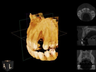 dental ct scan cbct