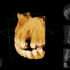 dental ct scan cbct