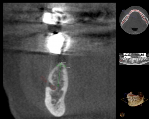 ct-image-with-guide