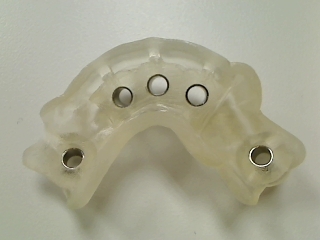 Surgical guide for dental implants