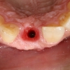Soft tissue
