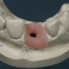 Final model