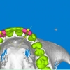 CBCT- 3D model