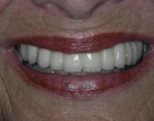 Final result