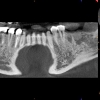 CBCT