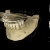 CBCT 3-D model