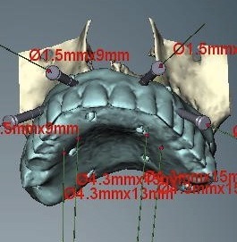 3-D CT work up 1