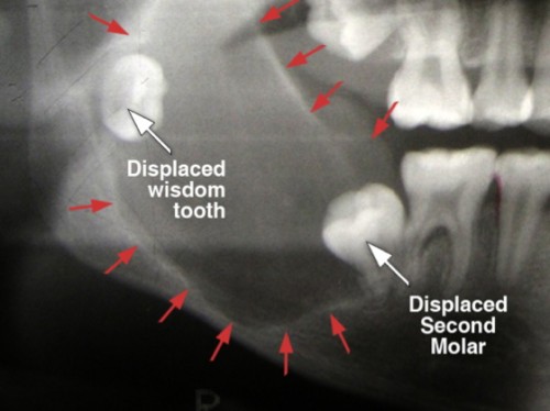 orthodontist washington dc
