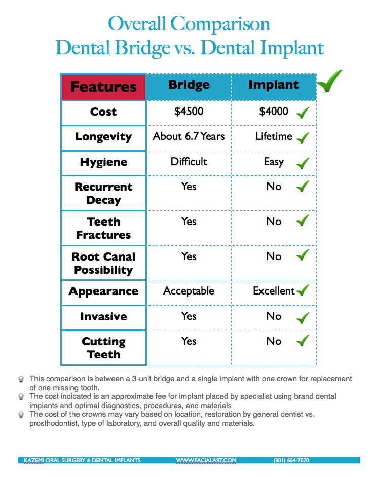 Comparison between dental implant and dental bridge