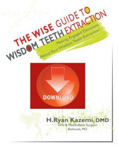 Wisdom teeth ebook download