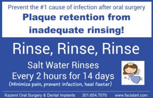 salt water rinsing after oral surgery extractions dental implant