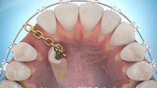 Kazemi oral surgery & dental implants