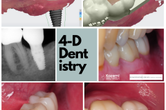Restoring bone and soft tissue and replacement with a dental implant