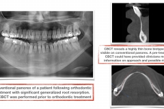 CBCT-benefits-in-orthodontic-treatments-root-resorption-kazemi-oral-surgery-and-dental-implants