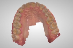 7. digital scan 3-shape oral surgeon best dentist bethesda