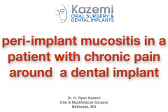 chronic-pain-dental-implant-peri-implantitis-mucositis-airflow-prophylaxis-master-kazemi-oral-surgery-1