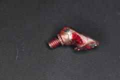 11.-dental-implant-gum-recession-peri-implantitis-infection-poorly-placed-kazemi-oral-surgery-bethesda